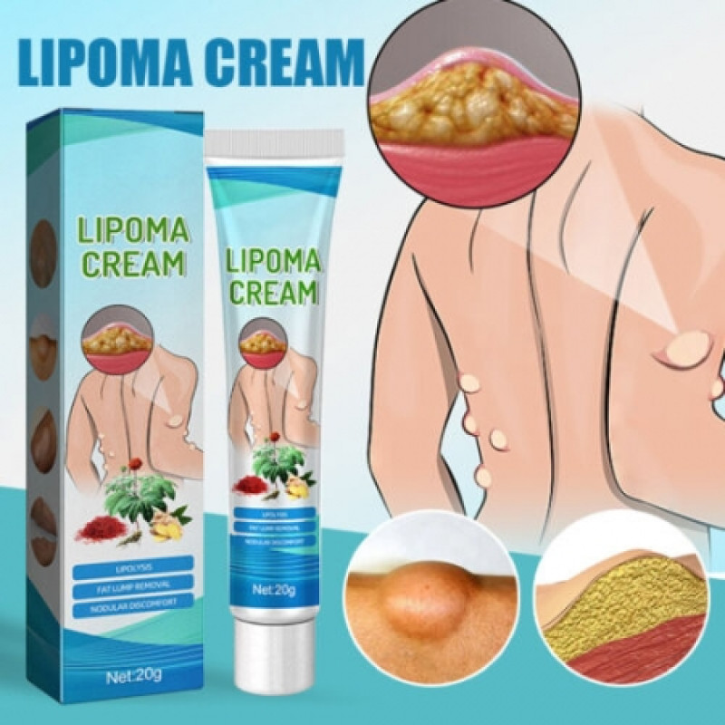 1 Pic Orzinal South Moon™ Lipoma Treatment Ointment